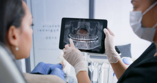 Licensed Dental Implants service in Mountain View, CA - Smile Center Dentistry
